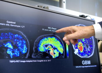 Con demenza 1,4 milioni di italiani, la quota più alta in Ue