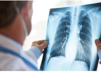 Curare il cancro al polmone senza chirurgia, prima italiana all’Ieo di Milano