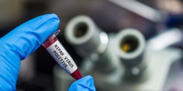 Ad aprile i primi test per un vaccino contro il virus Nipah
