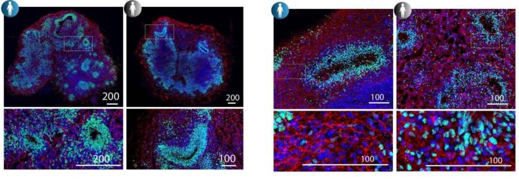 Studio italiano, ‘la Sma colpisce dall’embrione, cruciali screening e cure precoci’